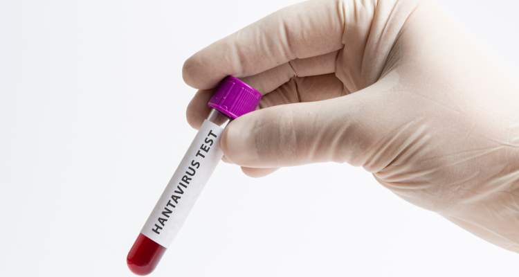 Kaj je hantavirus, ki ga prenašajo glodavci in lahko povzroči hude bolezni?
